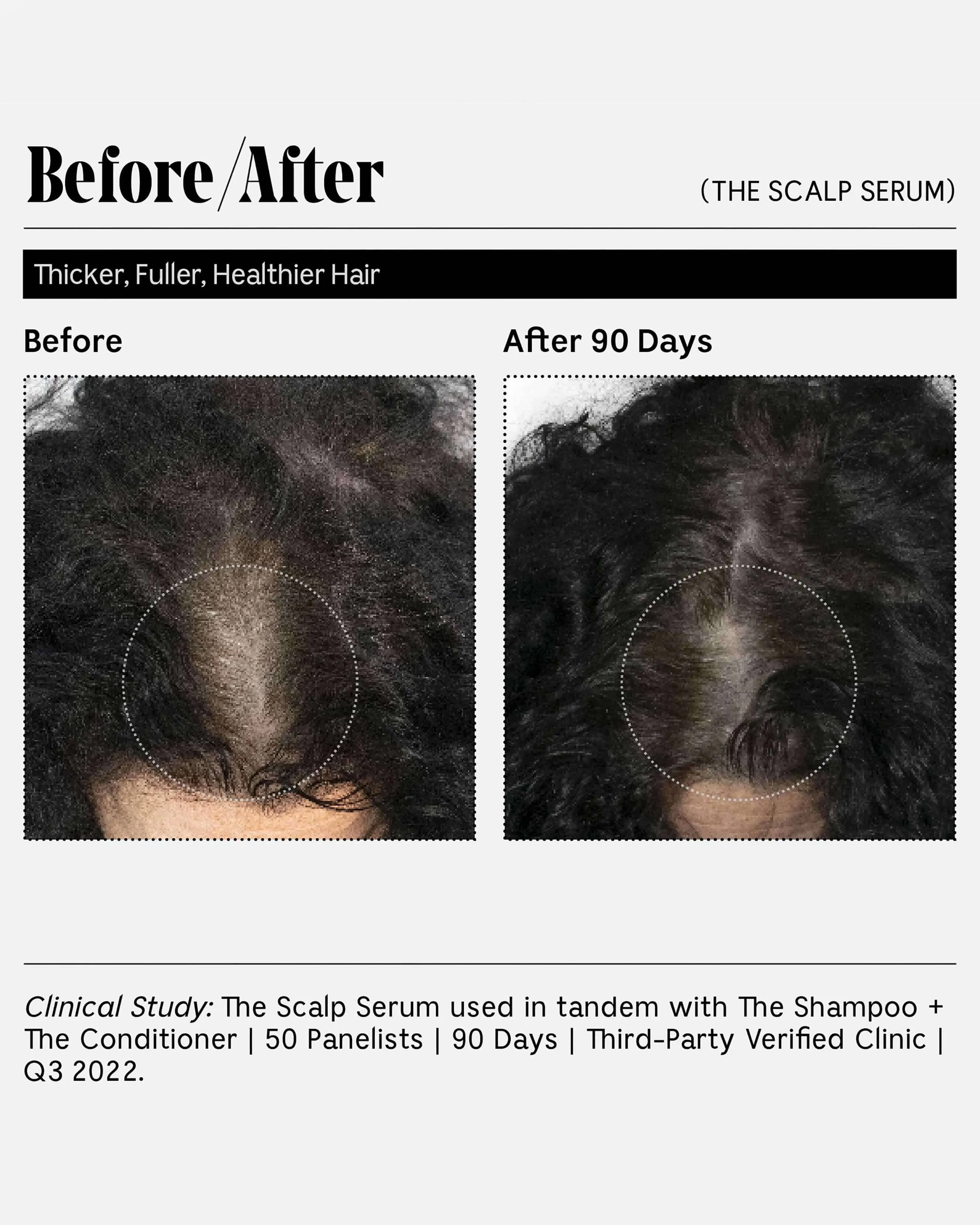 The Scalp Serum